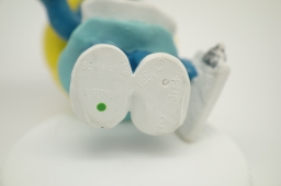 Schtroumpfette infirmière - photo