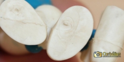 Schtroumpf poète - photo