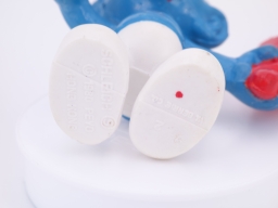 Schtroumpf avec frites - photo