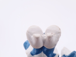 Schtroumpfette secrétaire - photo